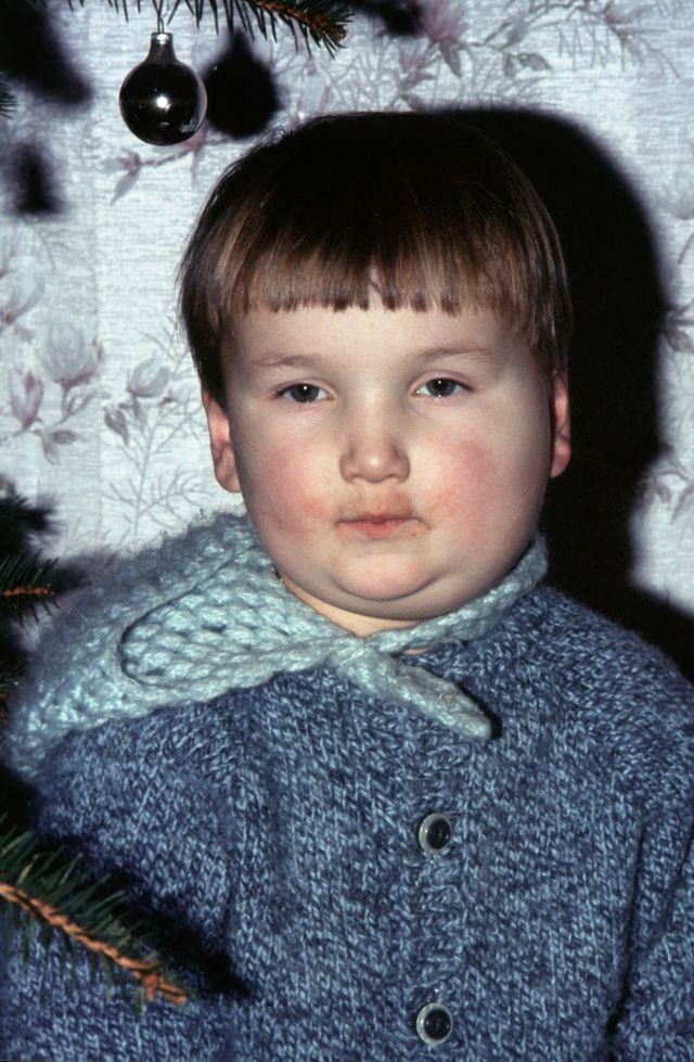 Mumps