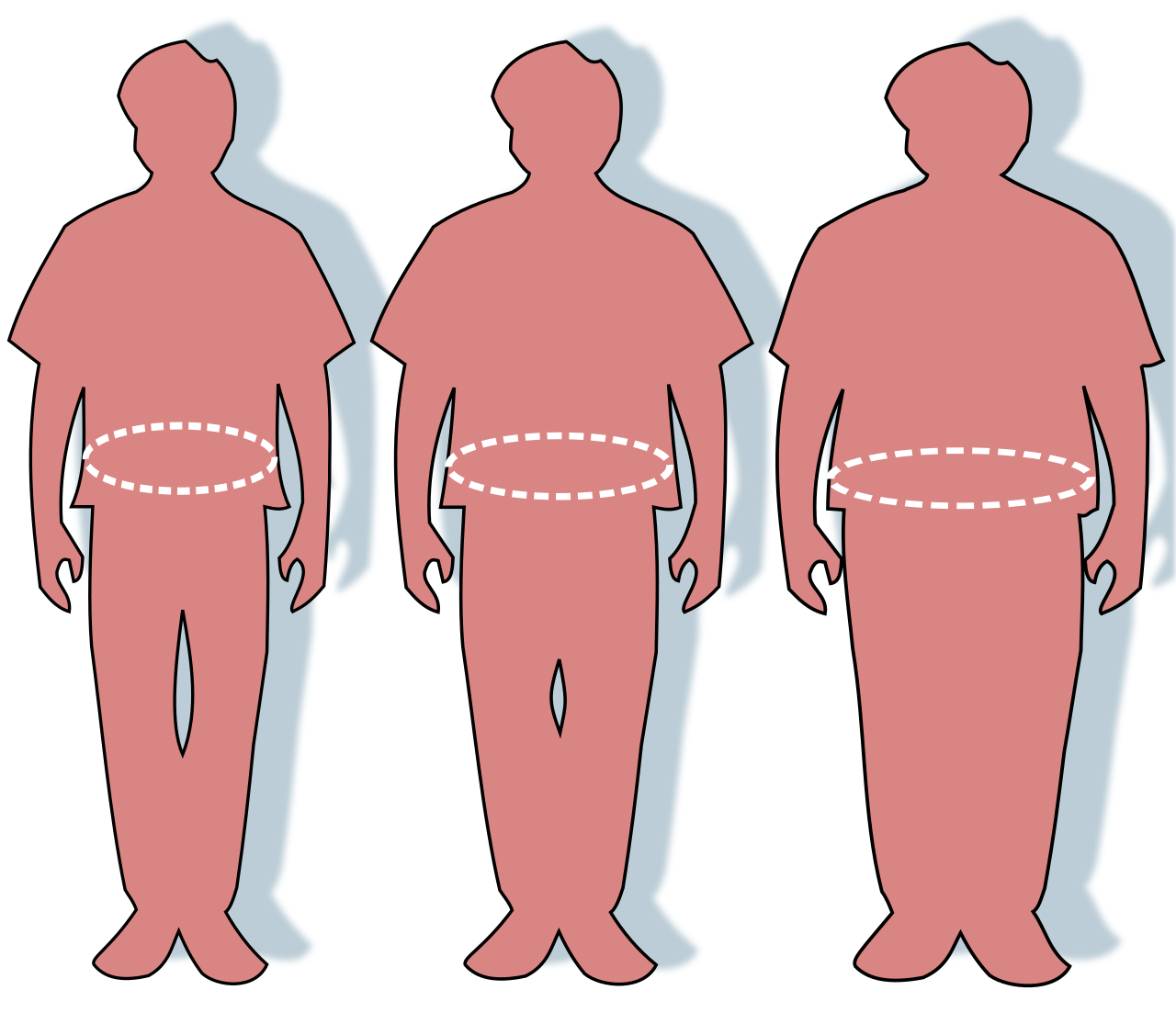 Obesity