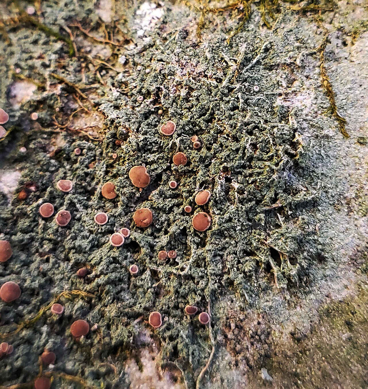 Rubella