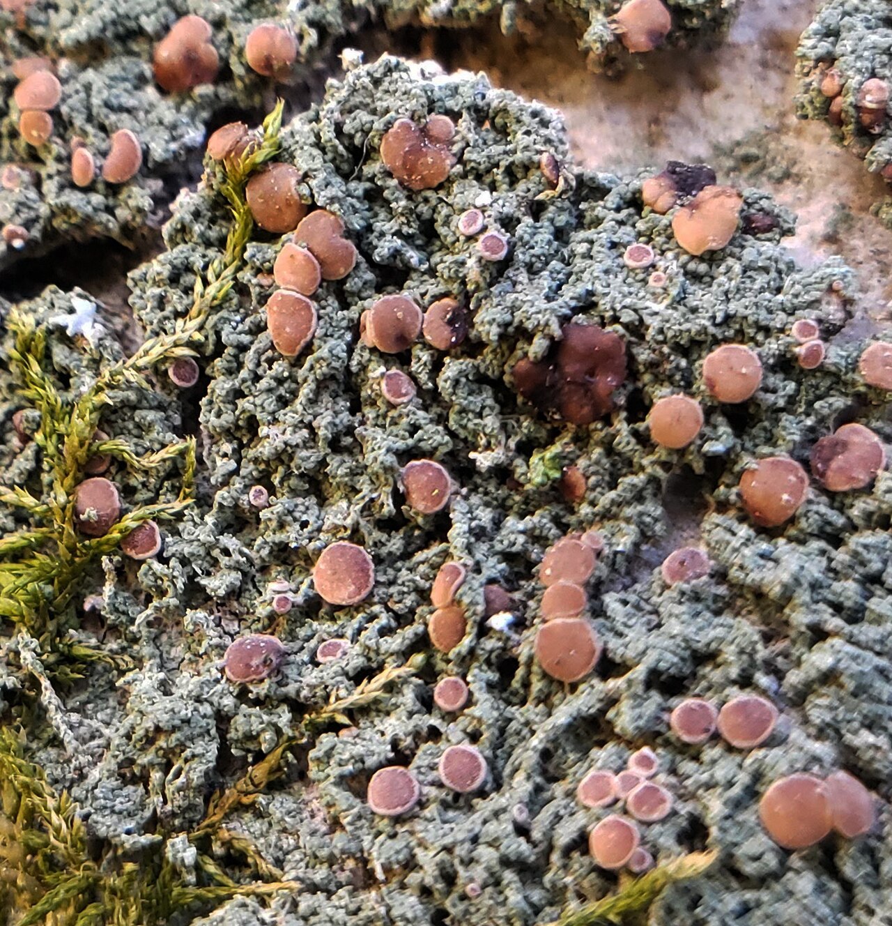 Rubella