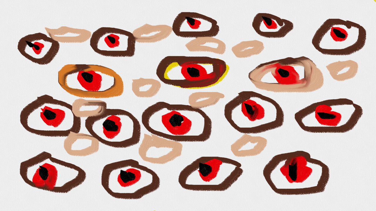 Schizophrenia